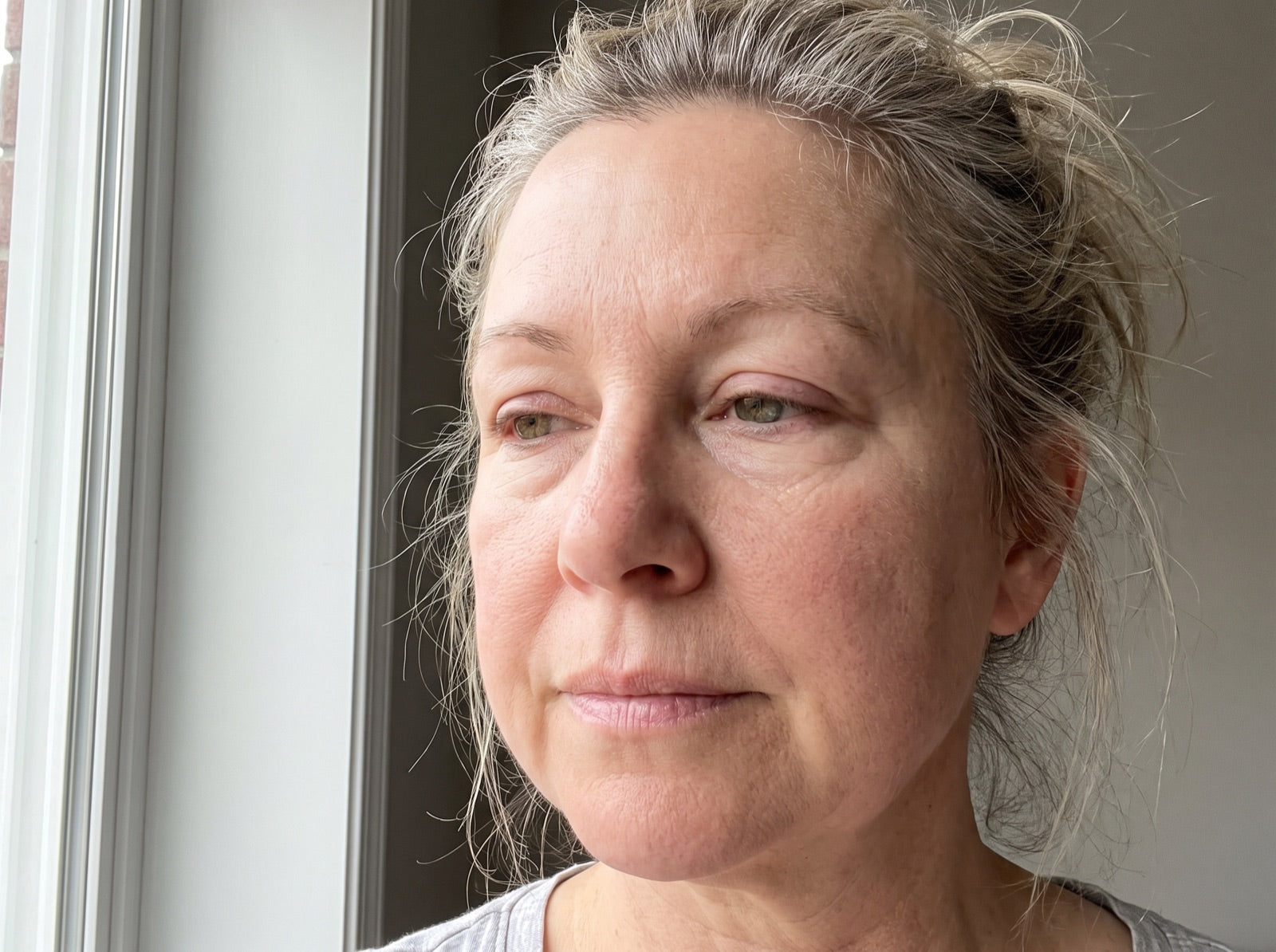Woman with a puffy morning face looking out the window