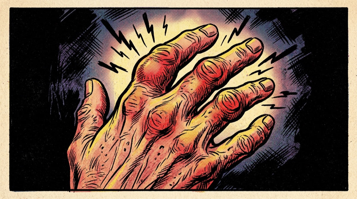 An old hand with inflamed, painful finger joints